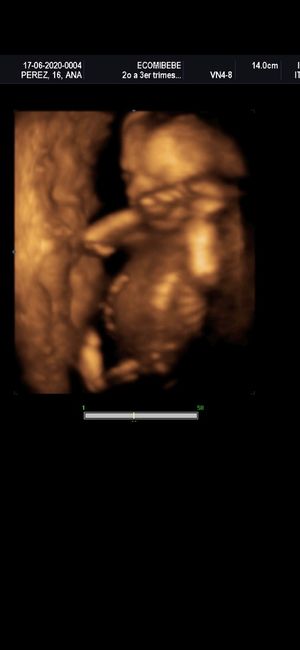 Futuras mamas noviembre 2020 - 2