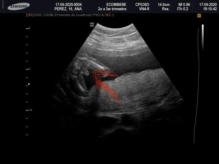 Futuras mamas noviembre 2020 - 3