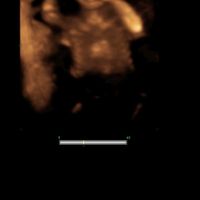 Futuras mamas noviembre 2020 - 1