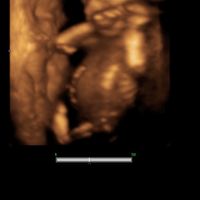 Futuras mamas noviembre 2020 - 2
