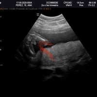 Futuras mamas noviembre 2020 - 3