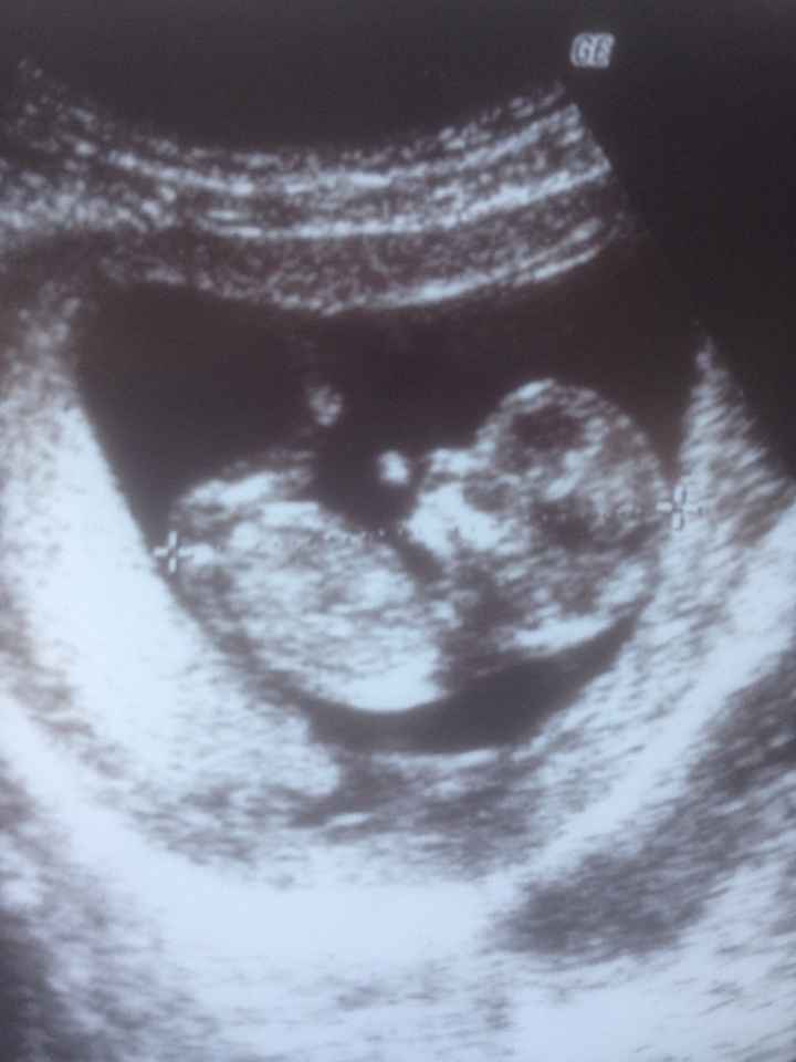 Bebe 1