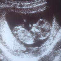 Bebe 1