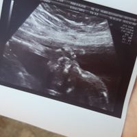 Futuras mamás marzo 2019 - 1