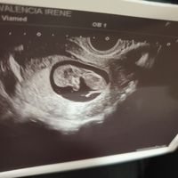 Ayuda con método ramzi: niño o niña? - 1