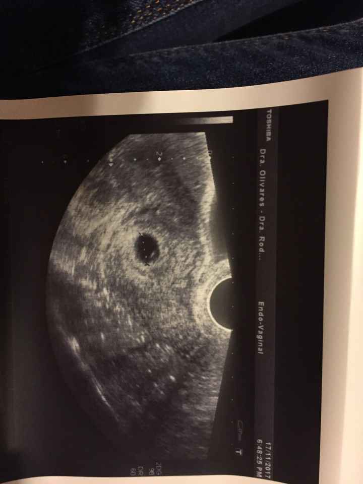  Futuras Mamis Julio 2018 - 1