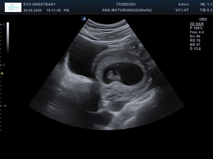 Futuras Mamis Enero 2021 - 2