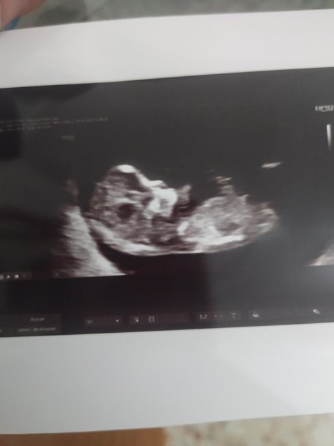 Futuras Mamis Enero 2021 - 1