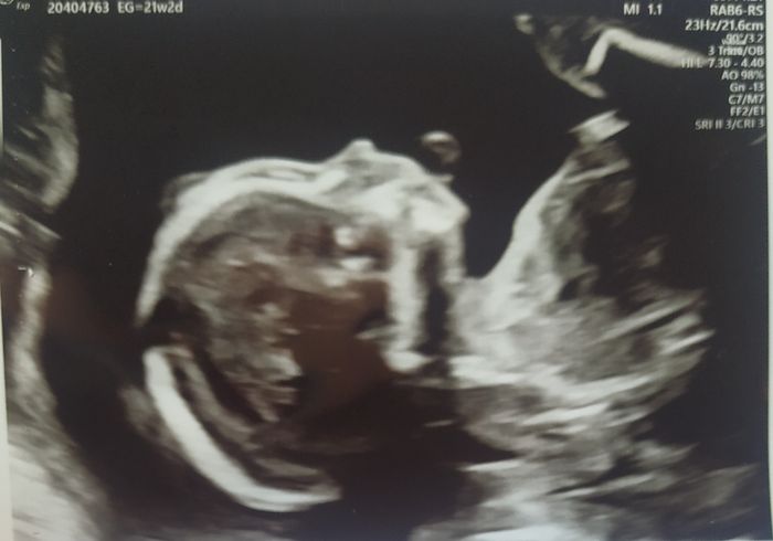 Futuras Mamis Enero 2021 - 1