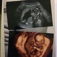 Futuras mamás abril 2017 - 1