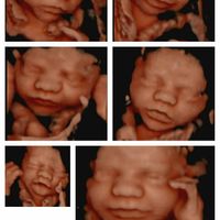 Futuras Mamis Julio 2018 - 1