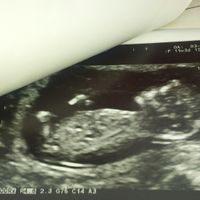  Futuras Mamis Julio 2018 - 1