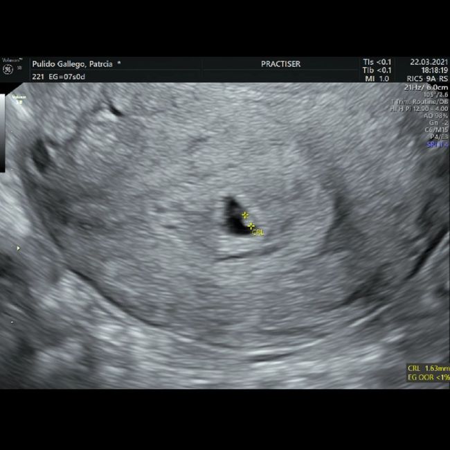Futuras Mamis Noviembre - 1