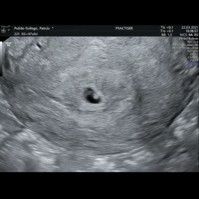 Futuras Mamis Noviembre - 2