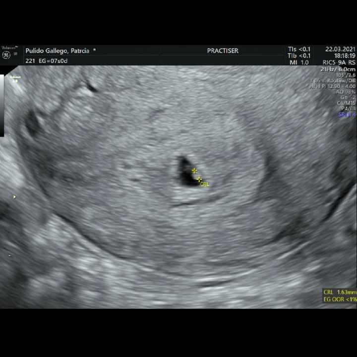 Futuras Mamis Noviembre - 1