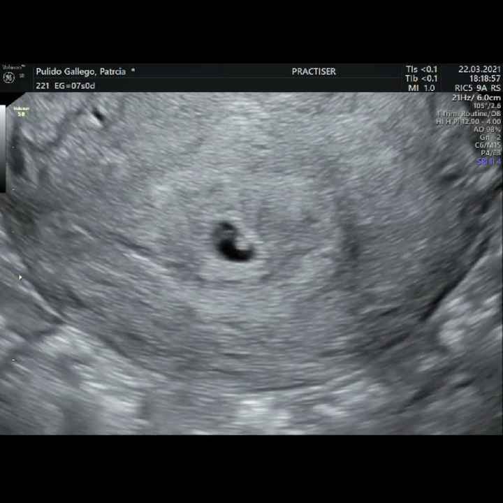 Futuras Mamis Noviembre - 2
