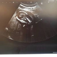 Mamis mayo 2020 v2.0 - 1