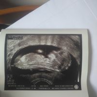 Eco 12+6