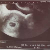 Ayuda con método ramzi: niño o niña? - 1