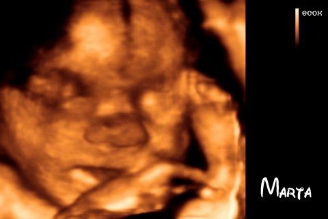 Mamis abril 2016 - 1