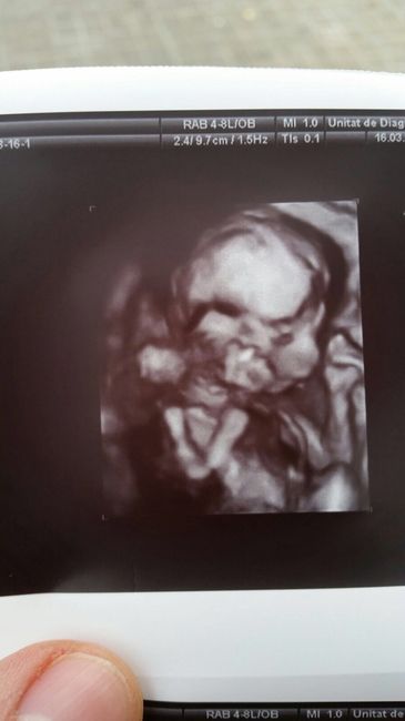 ¡¡futuras mamás agosto 2016!! - 1
