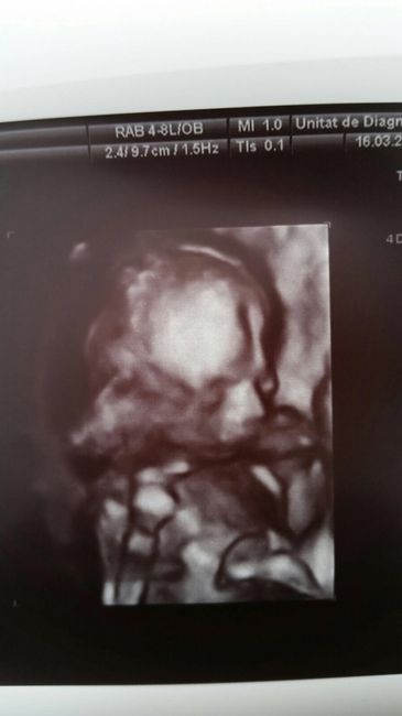 ¡¡futuras mamás agosto 2016!! - 2