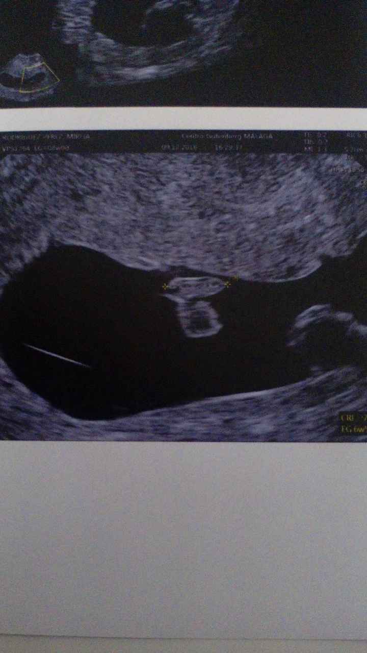 Futuro bb