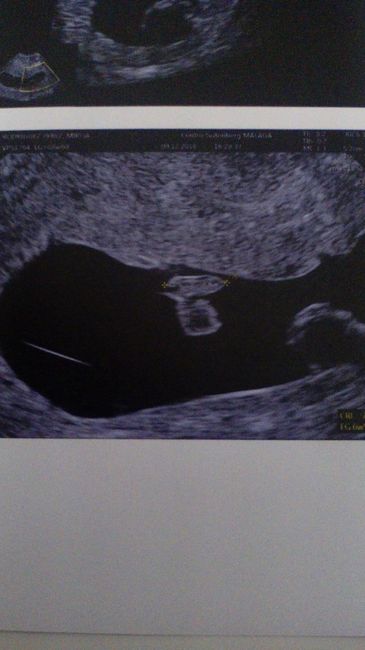 Futuro bb