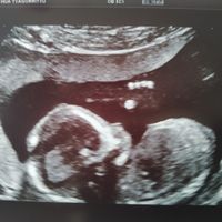 Futuras mamás julio 2021🤰🌹😍😍 - 1