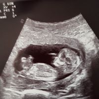 Futuras mamás Octubre 2018!!! - 1