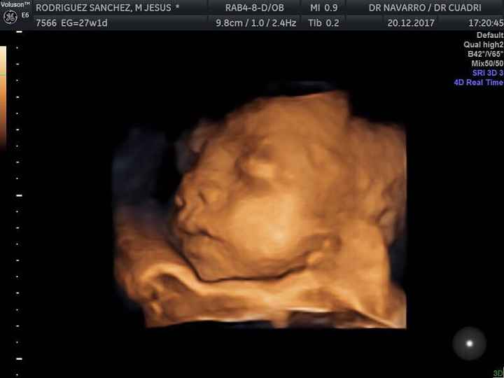 27 semanas 4D