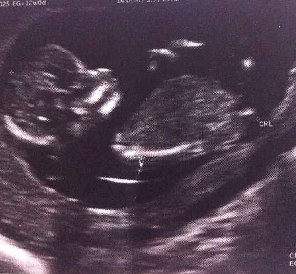 El consultorio de Lita para futuras mamis - 1