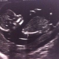 El consultorio de Lita para futuras mamis - 1