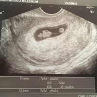 Futuras mamás Noviembre 2018! - 1