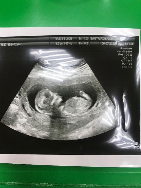 Futuras mamás Septiembre 2020 - 1