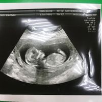 Futuras mamás Septiembre 2020 - 1