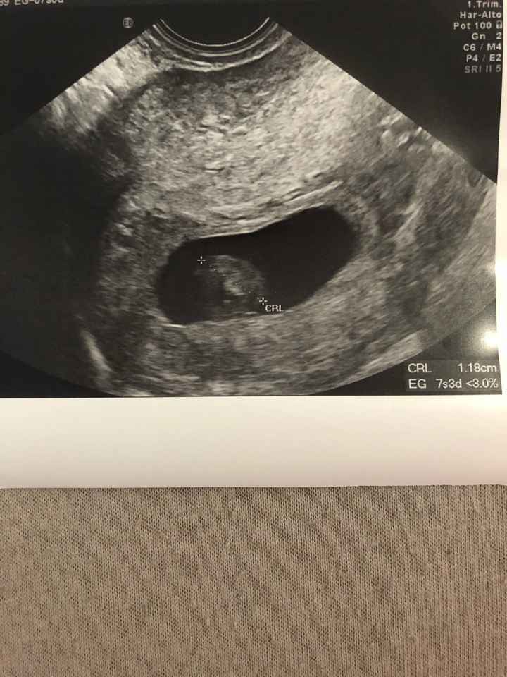 Futuras mamás marzo 2019 - 1