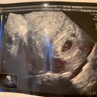 Futuras mamás Mayo 2021🤰♥️ - 1