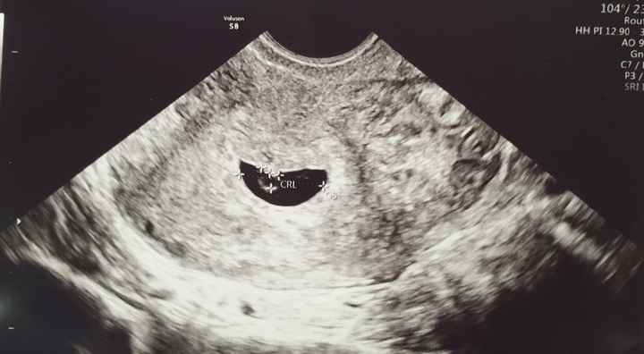Vaginal 6 semanas
