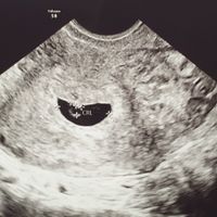 Vaginal 6 semanas