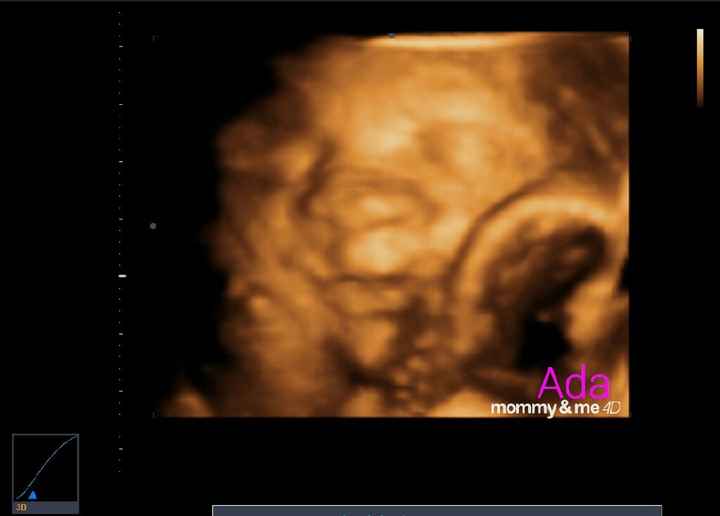  Futuras mamás Abril de 2018! - 1