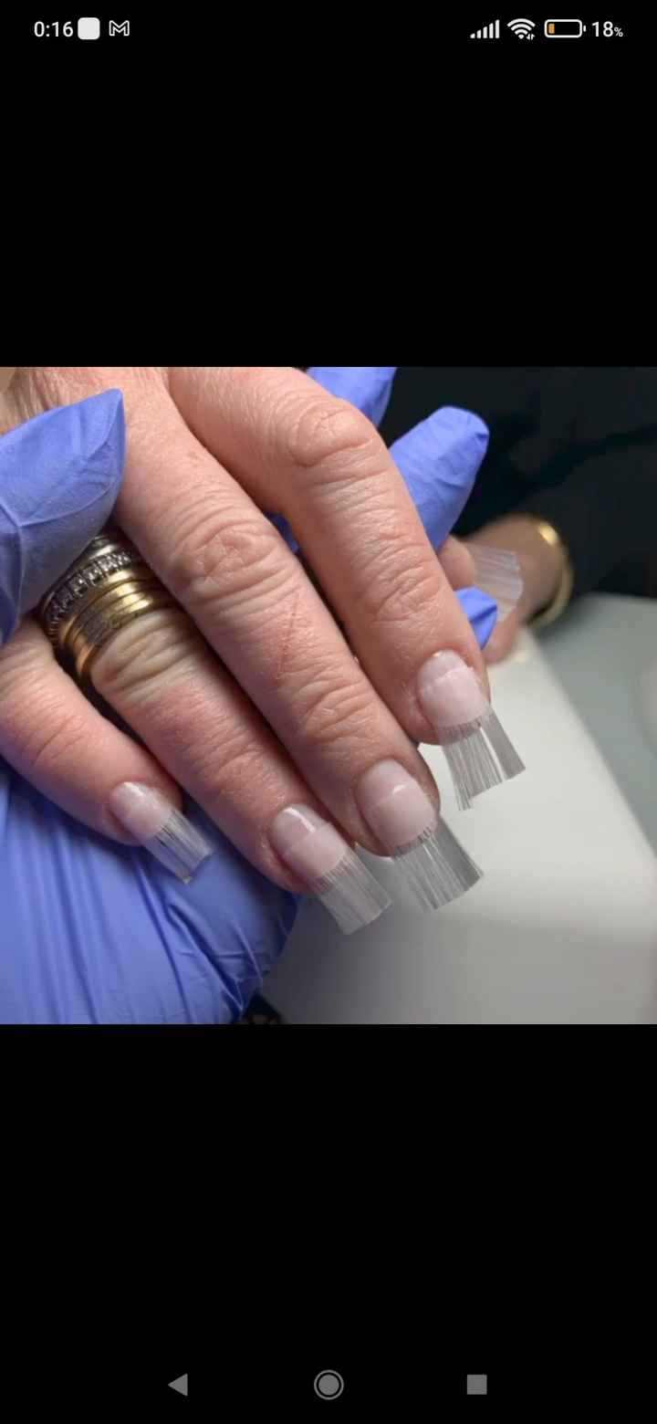 Uñas dañadas! - 1