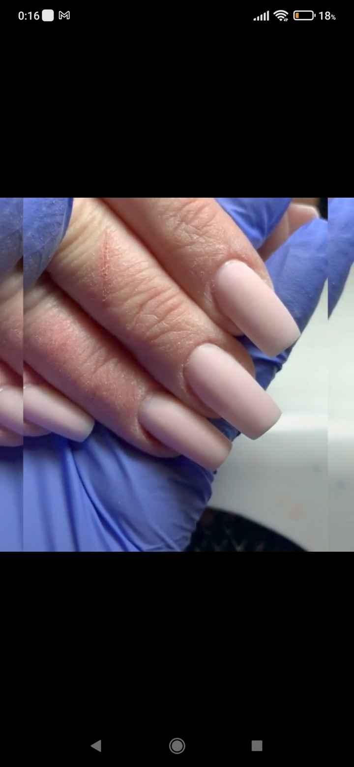 Uñas dañadas! - 2