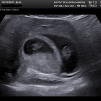 Futuras mamis Julio 2022! - 1