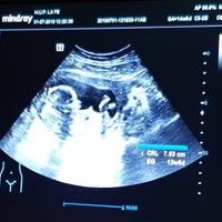 Futuras mamis diciembre 2019 oficial - 1