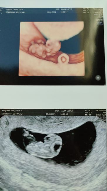 👶🏻futuras mamis febrero 2022👶🏻 2