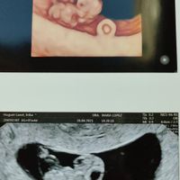 👶🏻futuras mamis febrero 2022👶🏻 - 1