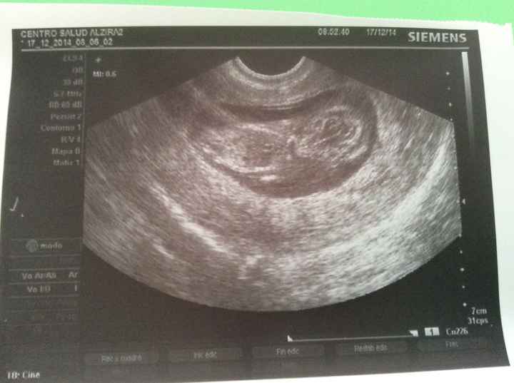 Eco 12 semanas