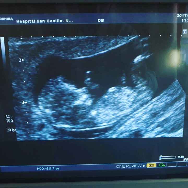  Futuras mamis junio 2018 - 1