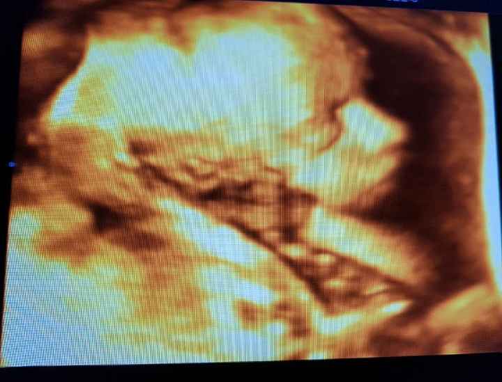 Futuras mamis junio 2018 - 1